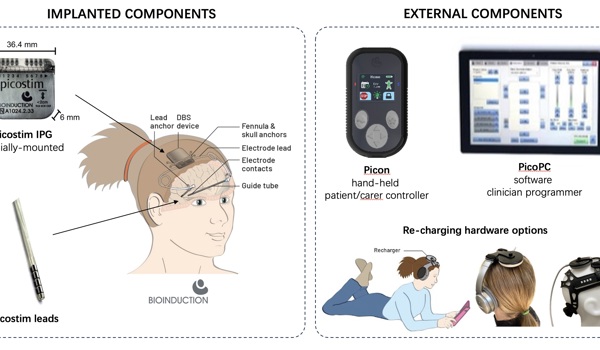 Children’s epilepsy treatment device wins The Engineer Collaborate to Innovate Award 2024