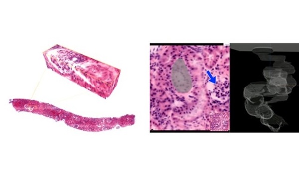 3DxN - Better understanding of disease through multi-modal imaging 
